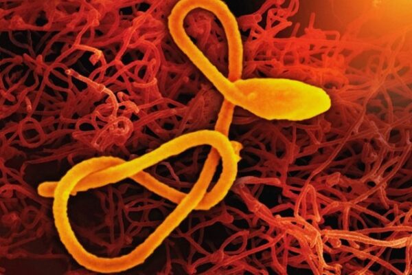 パラサイトクレンズ　やり方