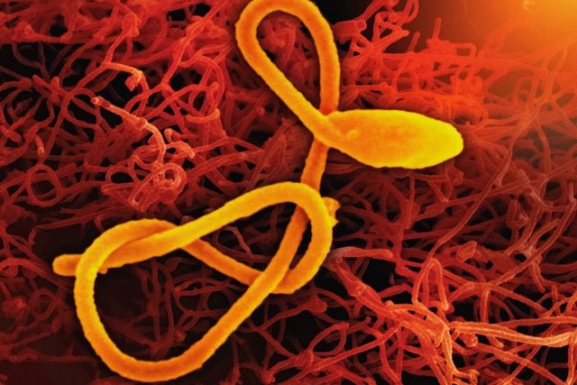 パラサイトクレンズ　やり方